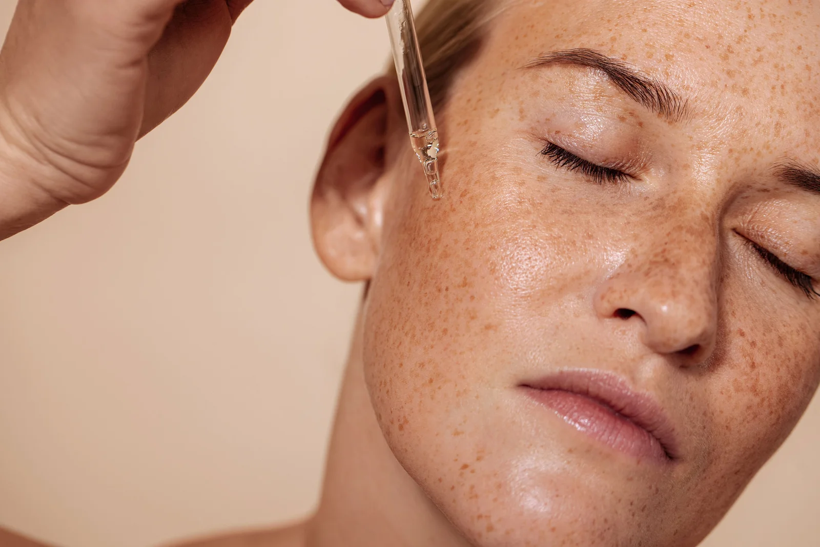Fight Back Against Acne: Learn How to Treat Mild Acne Today